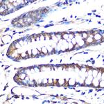 Aromatase Antibody in Immunohistochemistry (Paraffin) (IHC (P))