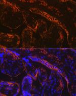 Aromatase Antibody in Immunohistochemistry (Paraffin) (IHC (P))