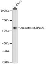 Aromatase Antibody in Western Blot (WB)