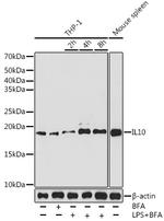 IL-10 Antibody in Western Blot (WB)