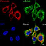 Fibronectin Antibody in Immunocytochemistry (ICC/IF)