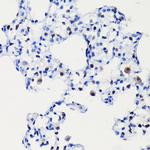 Cyclin D1 Antibody in Immunohistochemistry (Paraffin) (IHC (P))