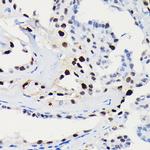 Cyclin D1 Antibody in Immunohistochemistry (Paraffin) (IHC (P))