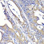 FASN Antibody in Immunohistochemistry (Paraffin) (IHC (P))