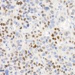 p21 Antibody in Immunohistochemistry (Paraffin) (IHC (P))