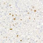 p21 Antibody in Immunohistochemistry (Paraffin) (IHC (P))