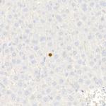 p21 Antibody in Immunohistochemistry (Paraffin) (IHC (P))