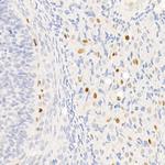 p21 Antibody in Immunohistochemistry (Paraffin) (IHC (P))