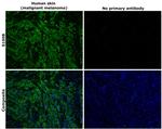 S100B Antibody in Immunohistochemistry (Paraffin) (IHC (P))