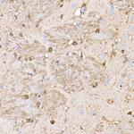 S100B Antibody in Immunohistochemistry (Paraffin) (IHC (P))