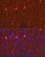 S100B Antibody in Immunohistochemistry (Paraffin) (IHC (P))