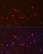 S100B Antibody in Immunohistochemistry (Paraffin) (IHC (P))