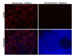 S100B Antibody in Immunohistochemistry (Paraffin) (IHC (P))