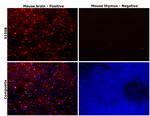 S100B Antibody in Immunohistochemistry (Paraffin) (IHC (P))