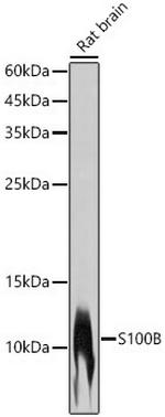 S100B Antibody in Western Blot (WB)