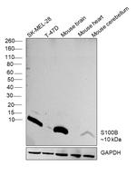 S100B Antibody in Western Blot (WB)