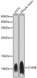 S100B Antibody in Western Blot (WB)