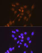 SMAD2 Antibody in Immunocytochemistry (ICC/IF)