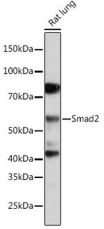 SMAD2 Antibody in Western Blot (WB)