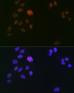 SPT5 Antibody in Immunocytochemistry (ICC/IF)