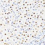 SPT5 Antibody in Immunohistochemistry (Paraffin) (IHC (P))