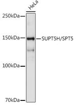 SPT5 Antibody in Western Blot (WB)