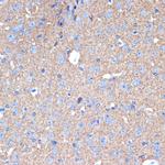 Syntaxin 1 Antibody in Immunohistochemistry (Paraffin) (IHC (P))