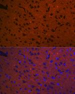 Syntaxin 1 Antibody in Immunohistochemistry (Paraffin) (IHC (P))