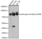 GUSB Antibody in Western Blot (WB)