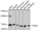 PROK1 Antibody in Western Blot (WB)