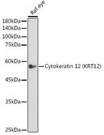 Cytokeratin 12 Antibody in Western Blot (WB)