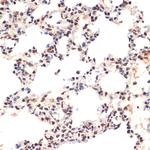 EHMT2 Antibody in Immunohistochemistry (Paraffin) (IHC (P))