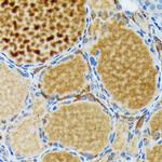 Thyroid Peroxidase Antibody in Immunohistochemistry (Paraffin) (IHC (P))