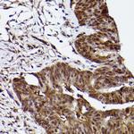 ERK1 Antibody in Immunohistochemistry (Paraffin) (IHC (P))