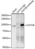 STAT5 beta Antibody in Immunoprecipitation (IP)
