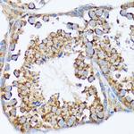 WAVE2 Antibody in Immunohistochemistry (Paraffin) (IHC (P))