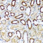 WAVE2 Antibody in Immunohistochemistry (Paraffin) (IHC (P))