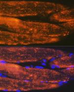 alpha Actinin 3 Antibody in Immunocytochemistry (ICC/IF)