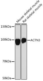 alpha Actinin 3 Antibody in Western Blot (WB)