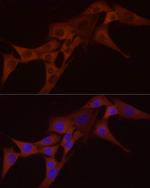 NFkB p65 Antibody in Immunocytochemistry (ICC/IF)