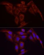 NFkB p65 Antibody in Immunocytochemistry (ICC/IF)