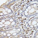 NFkB p65 Antibody in Immunohistochemistry (Paraffin) (IHC (P))