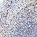 NFkB p65 Antibody in Immunohistochemistry (Paraffin) (IHC (P))