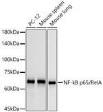 NFkB p65 Antibody in Western Blot (WB)