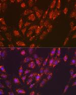 Versican Antibody in Immunocytochemistry (ICC/IF)