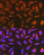 Versican Antibody in Immunocytochemistry (ICC/IF)