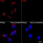 LC3B Antibody in Immunocytochemistry (ICC/IF)