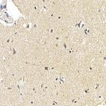 LC3B Antibody in Immunohistochemistry (Paraffin) (IHC (P))