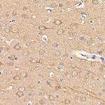 LC3B Antibody in Immunohistochemistry (Paraffin) (IHC (P))