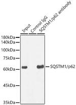 SQSTM1 Antibody in Immunoprecipitation (IP)